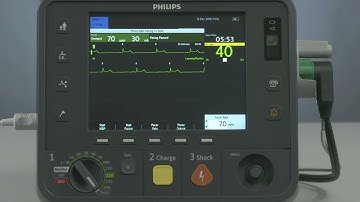 Non Invasive Transcutaneous Pacing with the HeartStart Intrepid monitor defibrillator