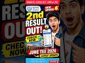 IGNOU 2nd Result 2026 OUT 😱 | June TEE Result Released | Check Now #shorts