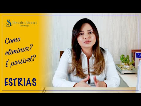 Vídeo: Estrias Nos Ombros: Causas E Prevenção