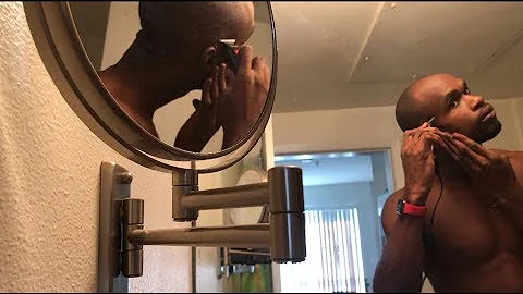 Going bald in your 20s: A Review