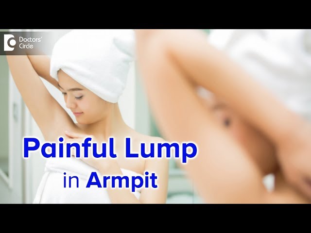 Painful armpit lump | Causes, Diagnosis and Treatment - Dr. Nanda Rajaneesh | Doctors' Circle class=