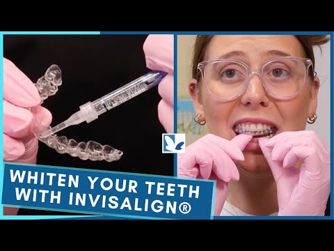 How to Whiten Teeth With Invisalign® Aligners?