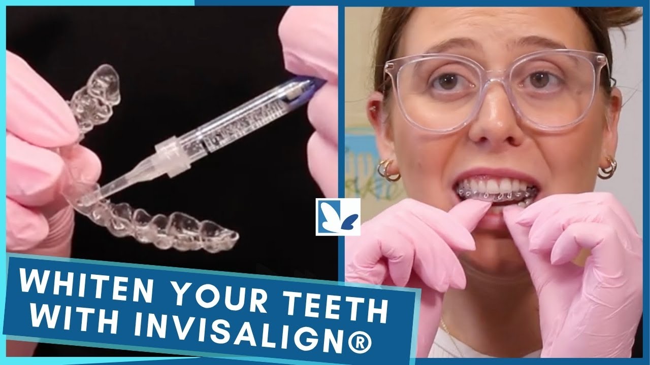 How to Whiten Teeth With Invisalign® Aligners? - YouTube