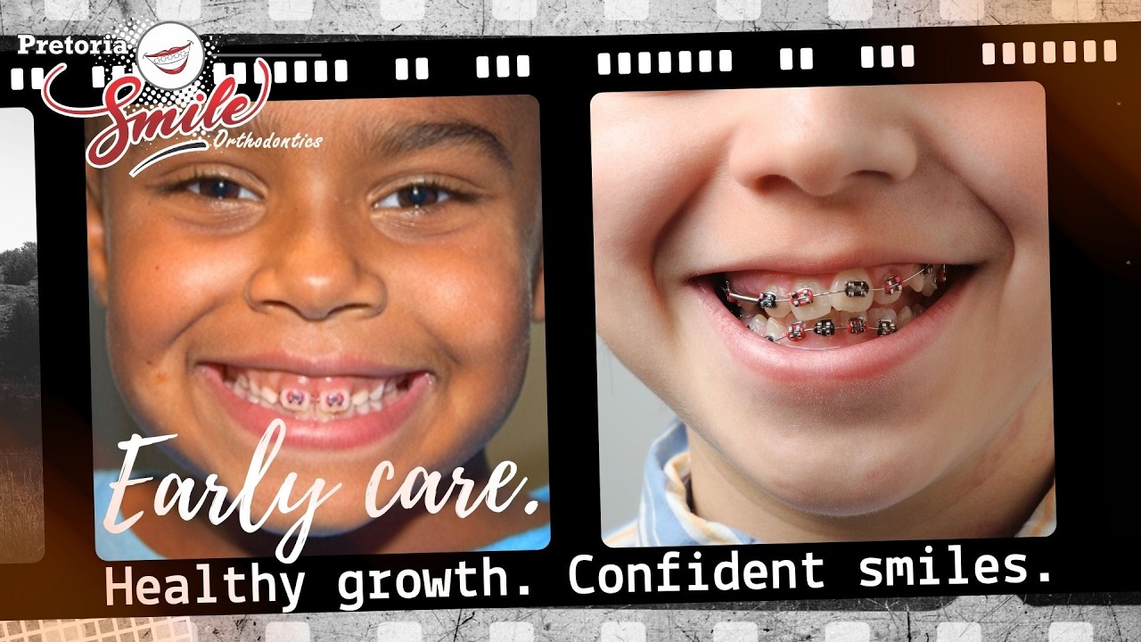 First Phase Treatment - PretoriaSmile Orthodontics