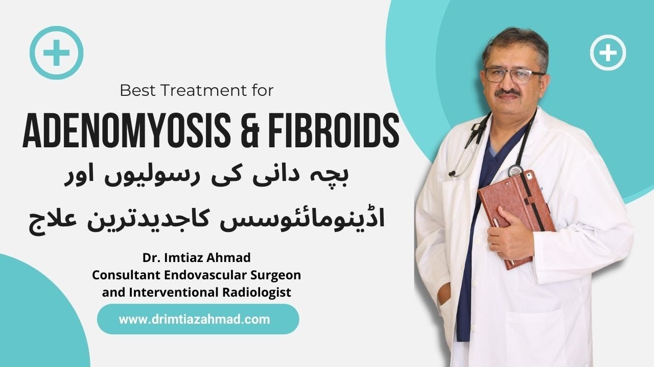 Latest Fibroids & Adenomyosis Treatment without Surgery فائبرائُڈ کا جدید علاج
