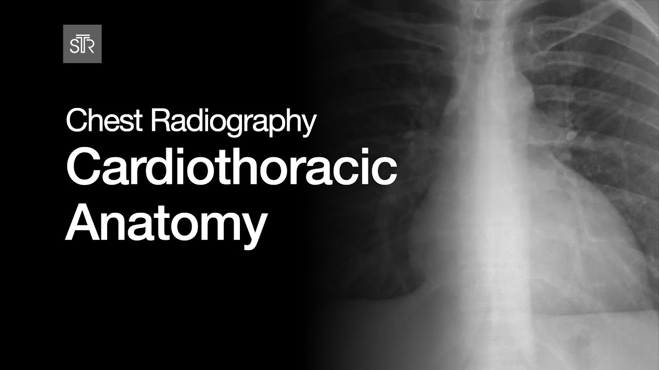 Chest Radiography Cardiothoracic Anatomy YouTube