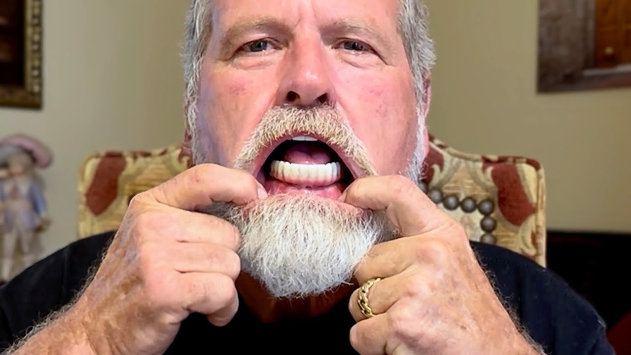 Outline Video My 3 Regrets about Full Dental Implants after a Year