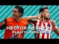 Hector Herrera&#39;s Plastic Surgery Transformation