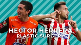 Hector Herrera&#39;s Plastic Surgery Transformation