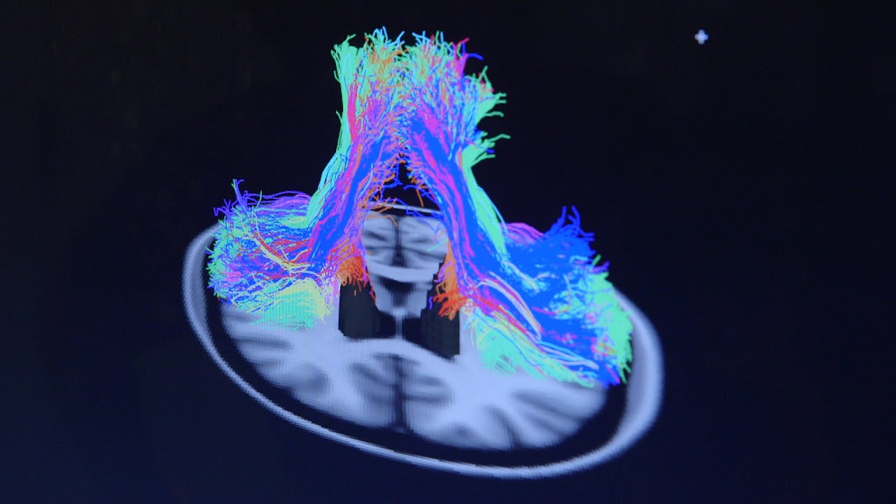 UCSF Dyslexia Center Phenotyping Project - Brain Imaging