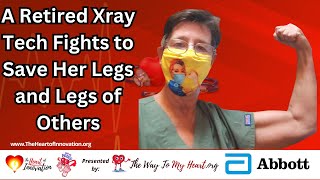 How A Retired Xray Tech is Saving Her Legs and Legs of Others