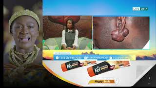 Keloids Explained — Causes, Treatment & How to Prevent Scar Overgrowth | Sunday Breakfast