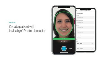 How to use the iTero Element™ 5D imaging system