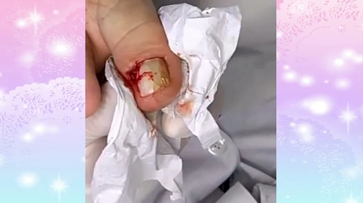 toenail cleaning satisfying Nasa Beauty