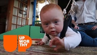 This Simple Harness Helps Down Syndrome Babies' Development!