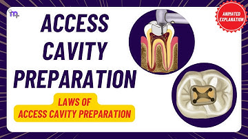 Access Cavity Preparation | Laws of ACP | Clinical tests | Procedure | Endodontics | Animated