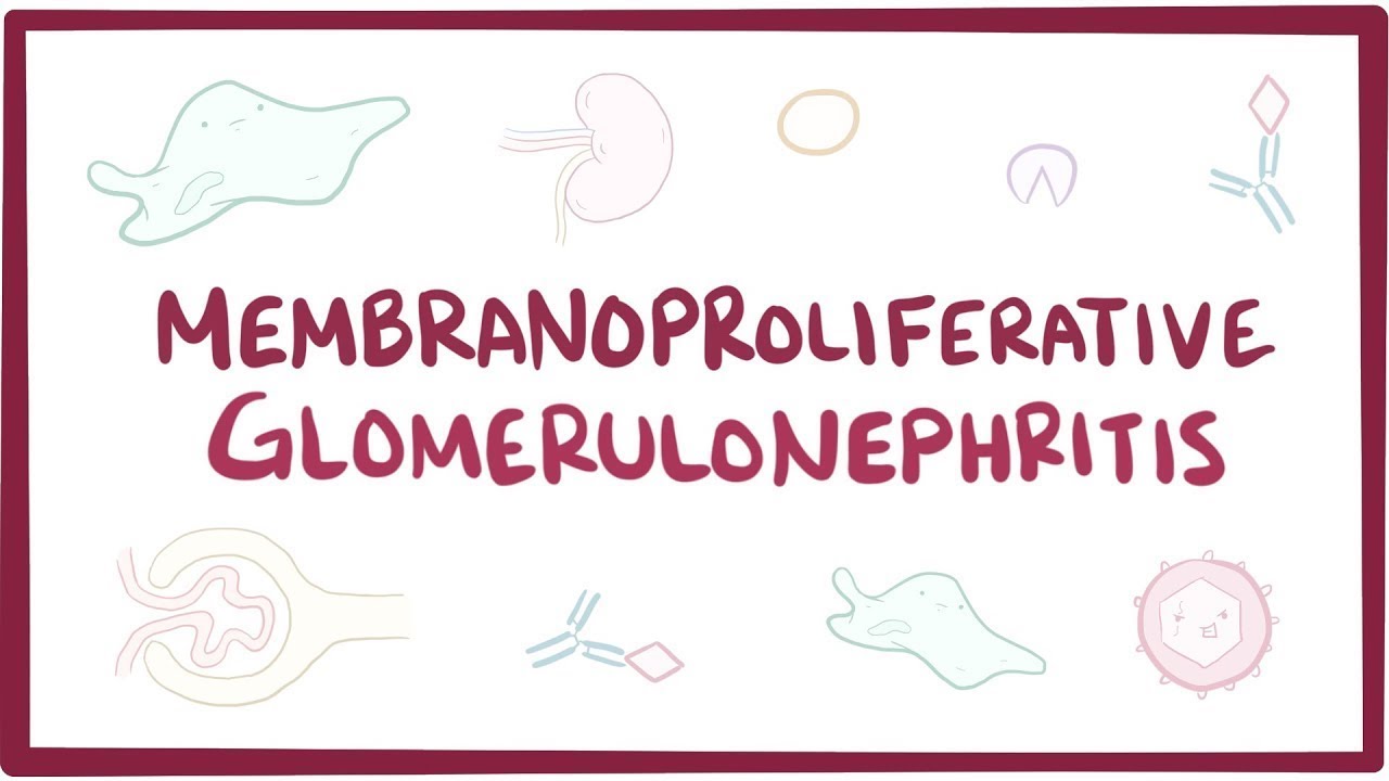 Membranoproliferative glomerulonephritis (MPGN) - an Osmosis preview osmosis 会社
