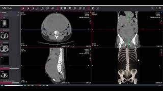 Viewer RIS-PACS Medxa