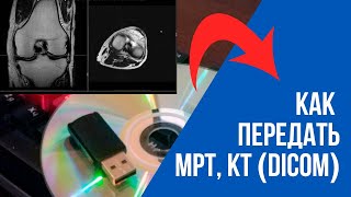 Как передать МРТ, КТ, рентген исследование DICOM? Онлайн консультация