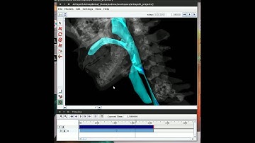 3D dynamic, interactive visualization of human swallowing with SPH