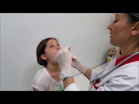 Video: Streptococ Hemolitic - Cauze, Simptome și Tratamentul Streptococului în Gât, în Frotiu