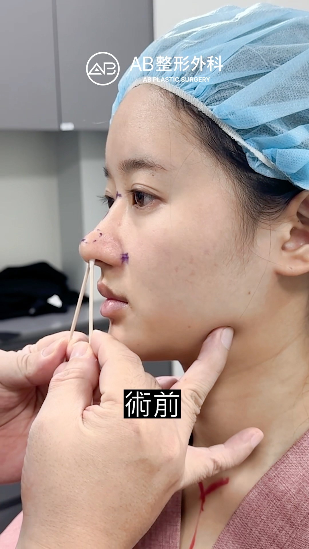 看完鼻子手術前後差，誰敢說沒用？ #shorts