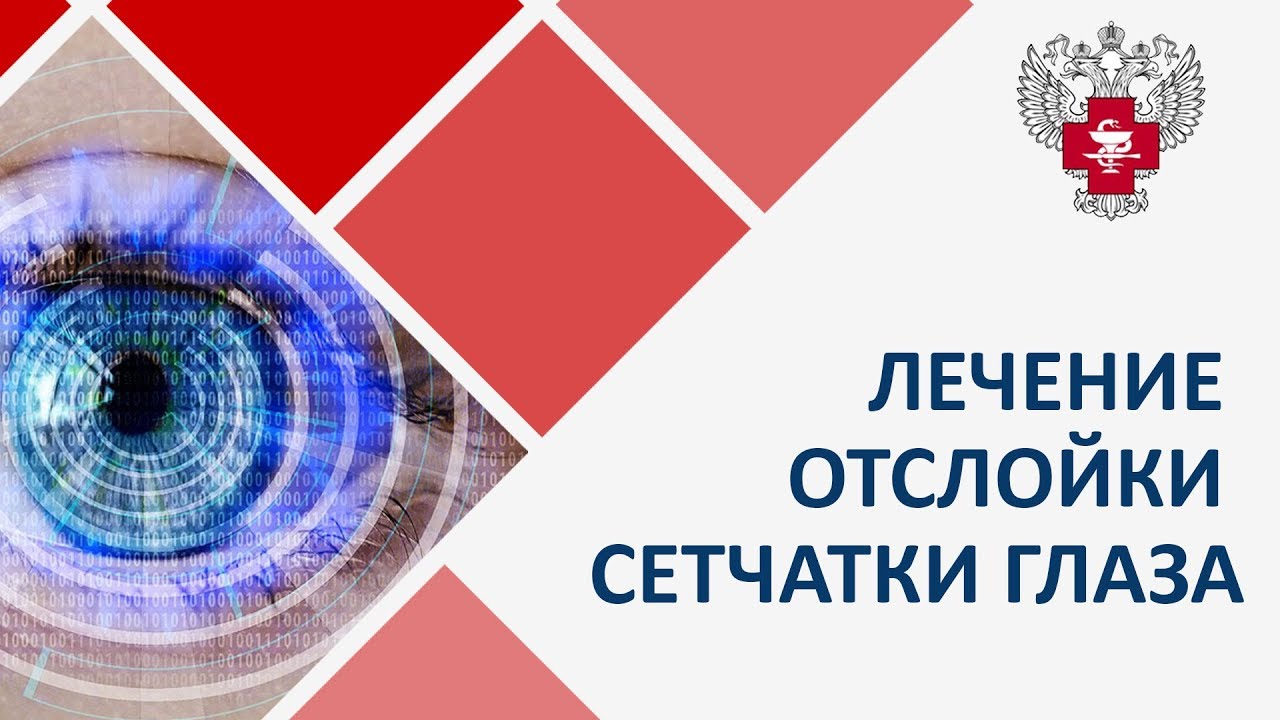 Отслойка сетчатки. 👀 Лечение отслойки сетчатки глаза, реабилитация ...