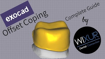 Exocad - Offset Coping