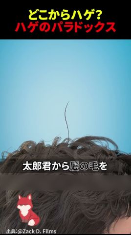 髪を1本抜いてもハゲないなら、いつ「ハゲ」になる？