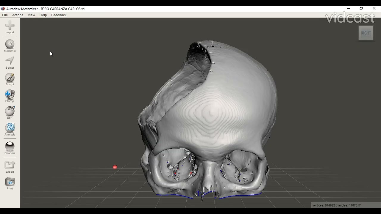 MESHMIXER archivos DICOM parte 1