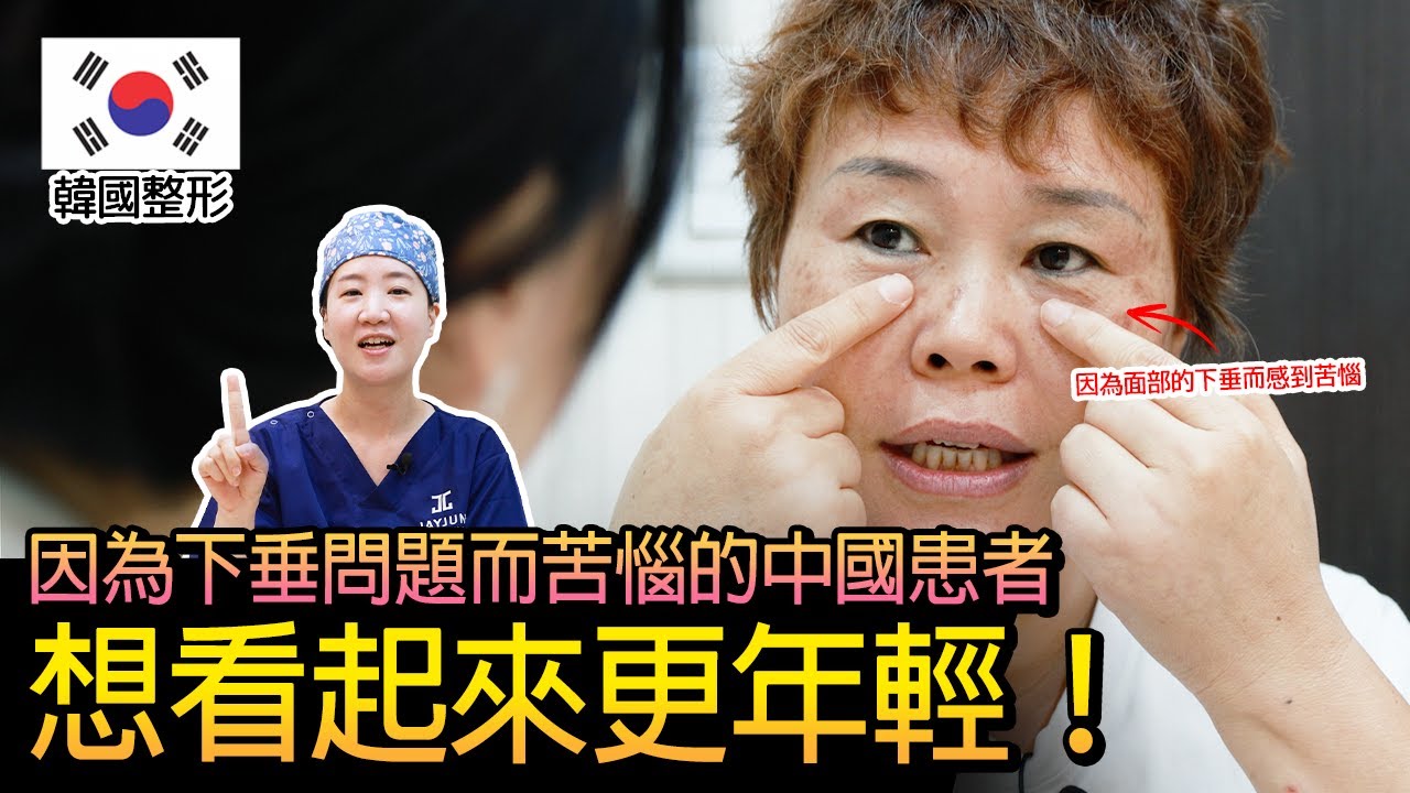 #皮膚下垂 #下眼臉 #眼底脂肪再配置 #法令紋 #真實故事