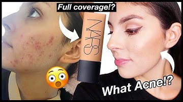 WOW! New Nars Soft Matte Complete Foundation Review on Acne