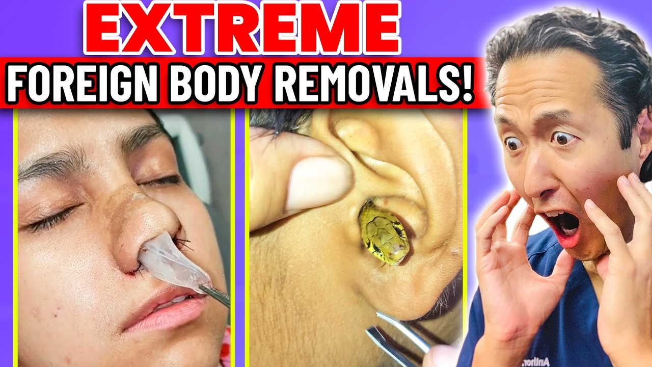Original Title & Thumbnail