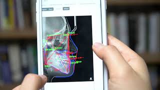 Famous WebCeph: AI(Artificial intelligence) web-based orthodontic analysis platform Profile