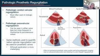 CSE and JASE Podcast February 1, 2024