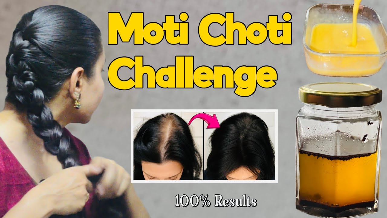 5 Days मोटी चोटी CHALLENGE : Regrow Lost Hair, Get Double Density & Thick Hair in 1 Week