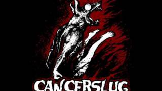 Watch Cancerslug Women And Dope video