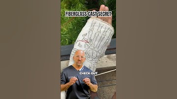 Cast Tip for a Better Broken Bone Experience #shorts