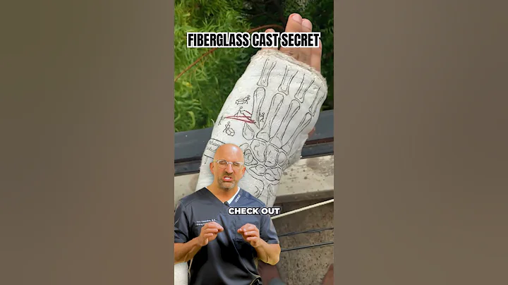 Cast Tip for a Better Broken Bone Experience #shorts