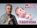 Гемангиома - Доктор Комаровский