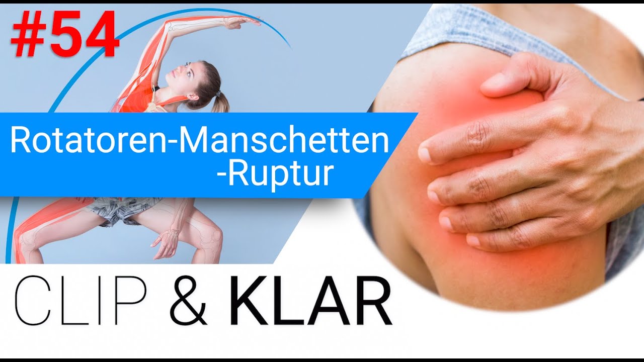 Rotatoren-Manschetten-Ruptur erklärt - Muskelriss mit Folgen
