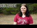 The Teen Who Smells Of Fish | BORN DIFFERENT