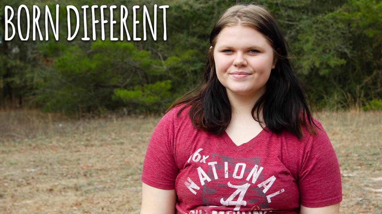The Teen Who Smells Of Fish | BORN DIFFERENT