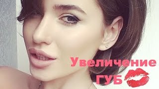 Увеличение Губ / До и После/ Мой Опыт, Ответы Врача, Цены(, 2016-12-01T13:56:06.000Z)