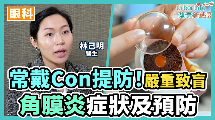 【角膜炎原因】戴Con增角膜炎風險　嚴重可致盲！了解症狀及預防 - 天天要聞