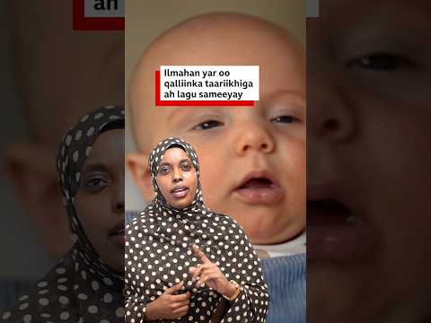 Muxuu yahay qalliinka taariikhiga ah ee lagu sameeyay ilmahan yar?