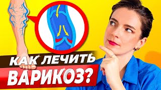 ВЕНЫ НА НОГАХ || Как убрать, чем лечить? Массаж, спорт, лекарства, народные средства при варикозе