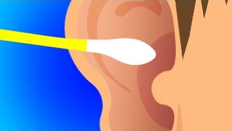 Earwax Clinic Game 👂 Earwax Clinic Game Ear Cleaning 👂 Gameplay  Levels 1-25