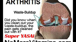Arthritis Behind The Kneecap by NoMoreVitamins com