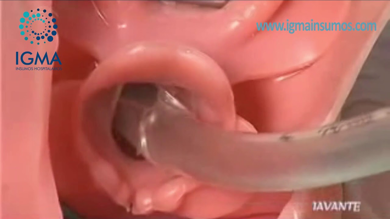 Intubación Endotraqueal